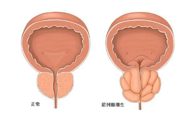 兩性健康 | 對于女性來說，最怕男人得什么病？(圖1)